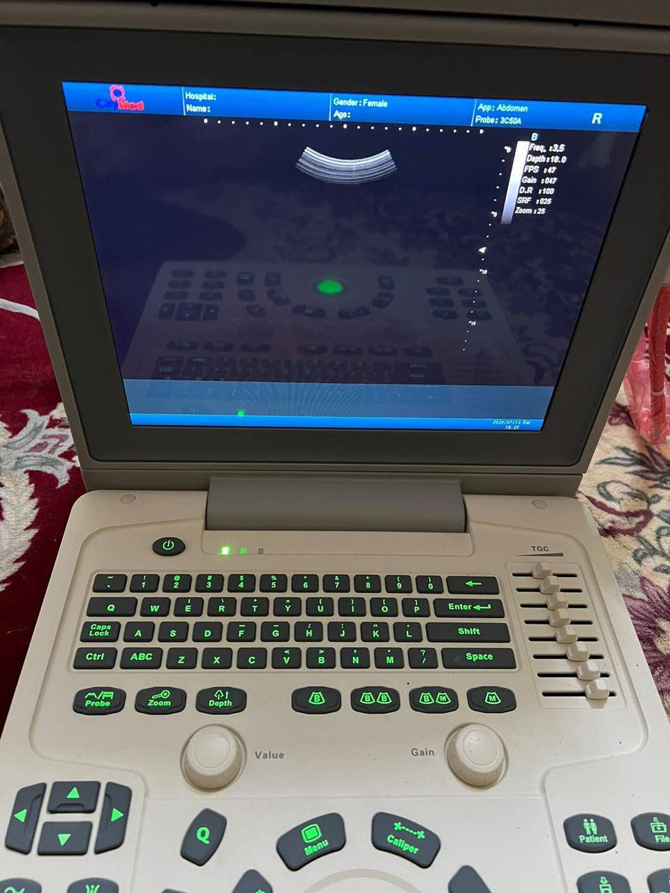 سونار بورتبل للبيع نظيف جدا في حالة الوكاله سنه الصنع 2023 مشتغل شهرين او اقل . للتواصل ***********
