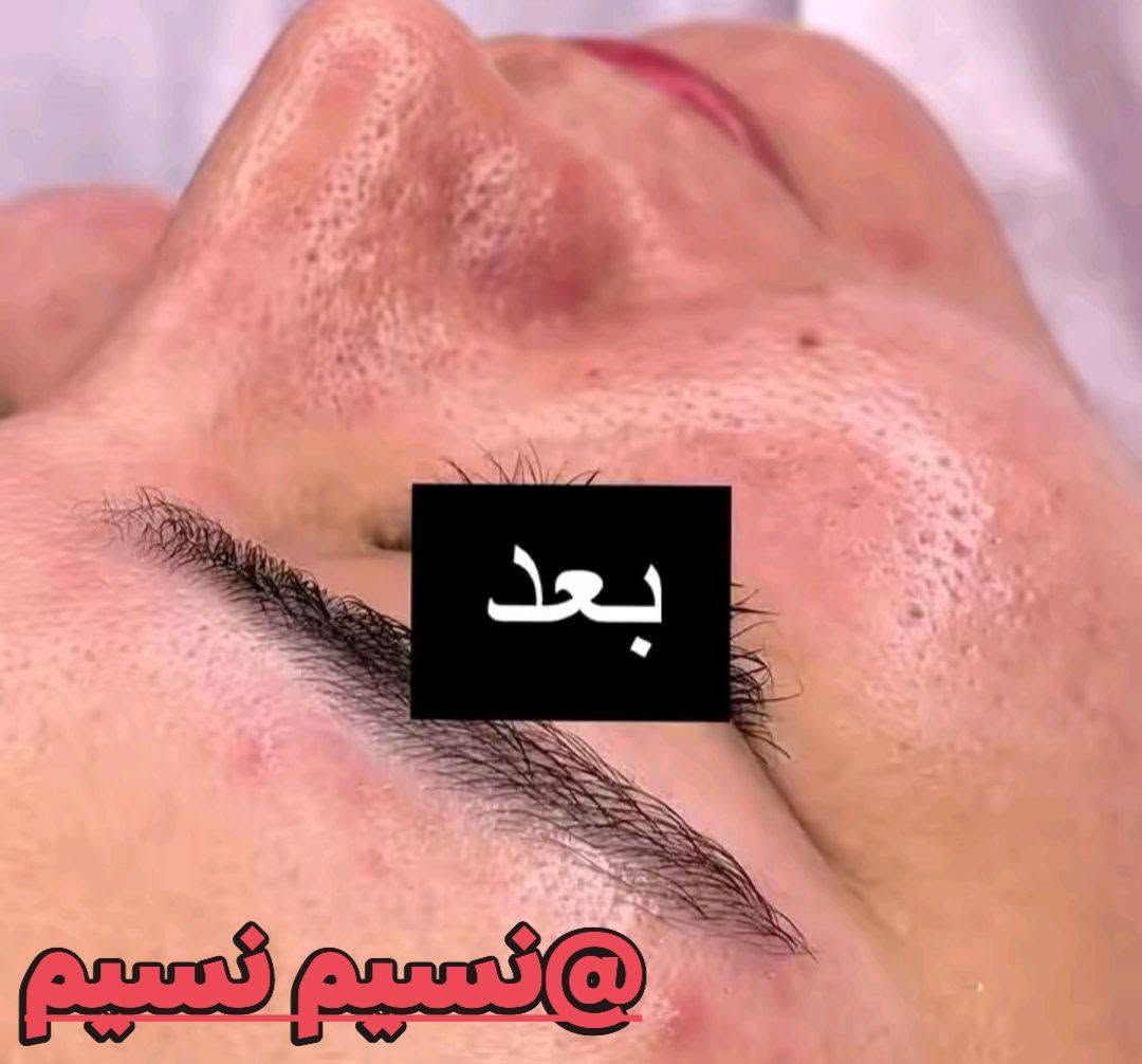 تنظيف بشره عميق هايدرو ب20 حالين عروض مستمره 

ام العصافير نزلت الصناعه حجز علخاص قبل بيوم 

@إشارة


**إذا كنت صاحب هذا الإعلان وتريد حذفه لأي سبب، رجاءا أرسل رسالة إلى الدعم الفني**