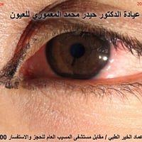 فولو • مجمع عماد الخير • مقابل مستشفى المسبّب