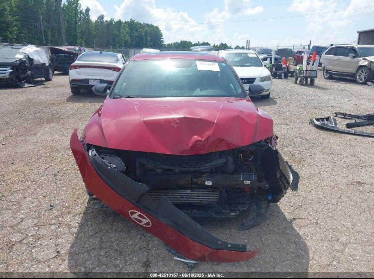 هونداي النترا 2024 N lain 
بصمه فتحه رادارات فول الفول 
ضرر بنيد فقط  بدون ايرباك بدون دواخل وبيها جاملغين رش امريكا رقم أربيل ترقيم جديد وكاله او تحويل انا حاظر 
السعر 15800$ سعرها 
للاستفسار ***********
مكان السياره بغداد حي الحسين بغداد, العراق
