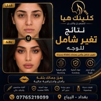 البياع • صالون تجميل • يمين مطعم السديل