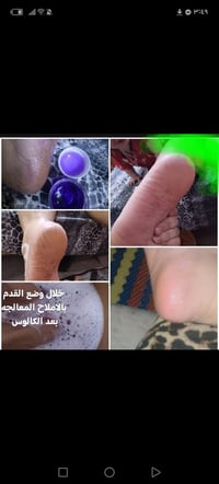 مزيل كالوس • أملاح القدم • مانع تعرق