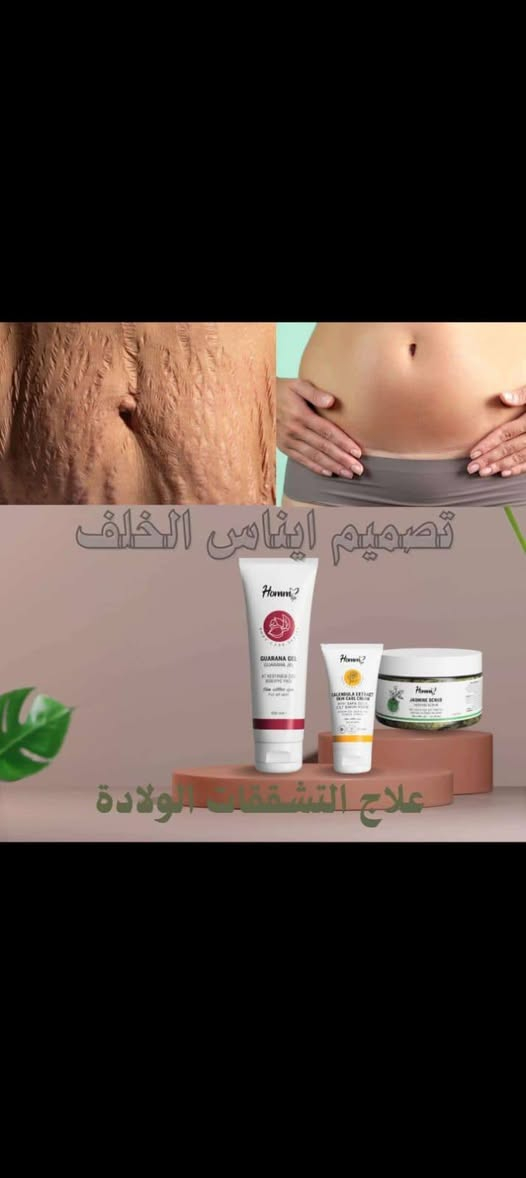 منتجات موثوقة ومضمونه طبيه للبشره ول جسم عروضنا مابتخلص ب الاضافه هدايااا مجانيه  😍ممميزة واصله لباب بيتك وين ماكنت توصلك شحن لجميع الدول يوجد كروب وتس للصحه والجمالhttps://chat.whatsapp.com/K43FH4d8uRCH94O2bL7WXPب الاضافه هدايااا مجانيه 😍🔥اكسبي اطلاله ملكيه ب العيد ببشره ونضاره خاليه من رؤؤس سودا والشوؤب عسولتي🍯


**إذا كنت صاحب هذا الإعلان وتريد حذفه لأي سبب، رجاءا أرسل رسالة إلى الدعم الفني**