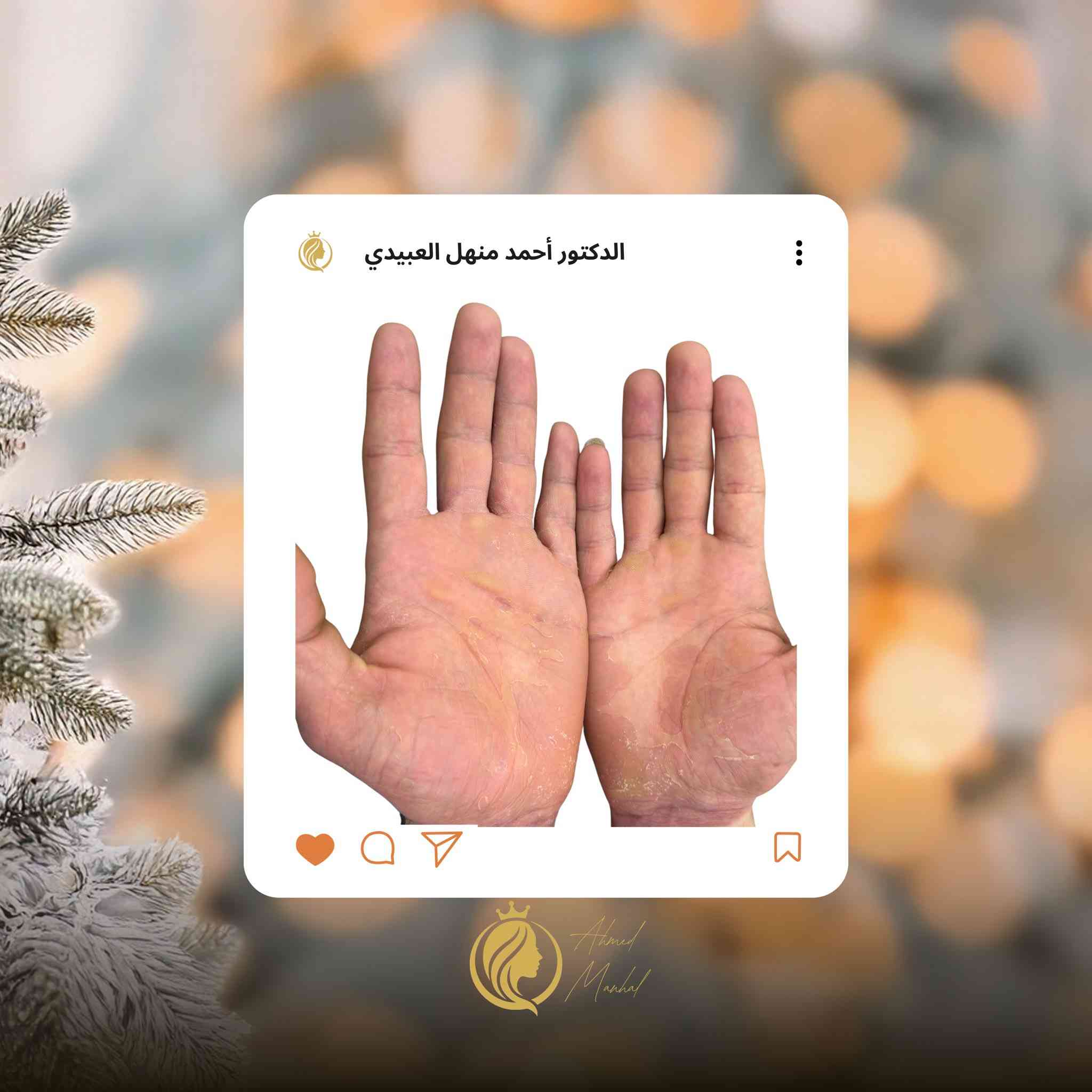 العلاج الصحيح يبدأ بتشخيص مبني على علم وخبرة.
قرارات طبية دقيقة لا تترك مجالًا للتجربة.
هنا تُدار الحالات بثقة،
لأن النتيجة مسؤولية وليست احتمالًا.

عيادة الدكتور أحمد منهل العبيدي
📍 مجمع البرج الأبيض – حي البريد
📞 ***********
📞 ***********
