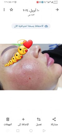 كربلاء قنطرة السلام • صالون الروان • فيلر بوتوكس هيدرافيشل