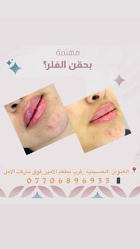 عيادة مصطفى التميمي للتجميل والليزر لأن جمالك يستحق الأفضل 🌸 فلر _بوتك...