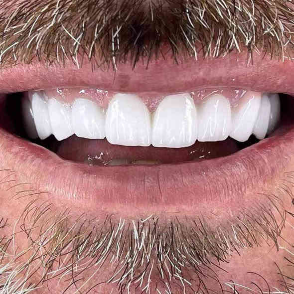 المختبر الفني السوري  لصناعة الاسنان
و التعويضات السنية وتركيب الأسنان
وبأنسب الاسعار بجميع المحافظات
العراقية 
ملاحظة لدينا كادر يزور المريض للبيت ويتم العمل في المنزل 
 للتواصل. ***********
