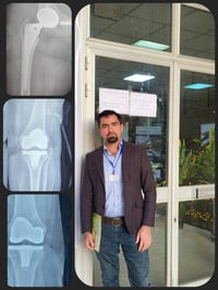 طبيب عظام • تبديل مفاصل • ناظور ركبة