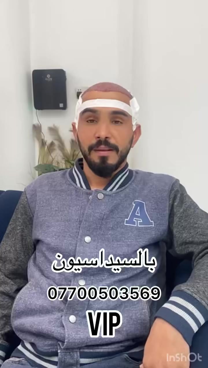 ازرع شعرك بطريقة حديثة ومختلفة 

بالسيداسيون المخدر العجيب 
 
زراعة vip  وللشخصيات المهمة 

فقطVIP عمليات مختلفة جذريا

مركزنة يختلف بالتقنية  والكثافة والاجهزة 

جهاز عدسة مكبر تشخيص  الشعر قبل قطف البصيلات 
نتيجة حصول على. اكبر عدد ممكن 🖌️

بصيلات  ثلاثية وثنائية حصرآ 
المخدر العجيب  بالسيداسيون  🔥😎

وبشرط خدر تام  ) صفر الم 

   

عيادة مرخصة من قبل وزارة الصحة العراقية

بشراف دكتور. أخصائي الجراحة التجميلية

اقتطاف  من المانحة بشكل هندسي 👍

بدون اي تشوه او فراغات  بعد زراعة ضمان وامان

عملية vip تكون مختلفة عن الزراعة التقليدية 
وفرق في الوقت العملية بحدود ساعتين  🙏

عن العمليات الاخرى 

سارعو بالحجز على الارقام 

✅*********** ***********بغداد  / زيونه

