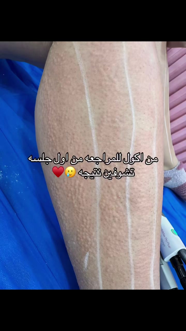 استغلو العروض


**إذا كنت صاحب هذا الإعلان وتريد حذفه لأي سبب، رجاءا أرسل رسالة إلى الدعم الفني**