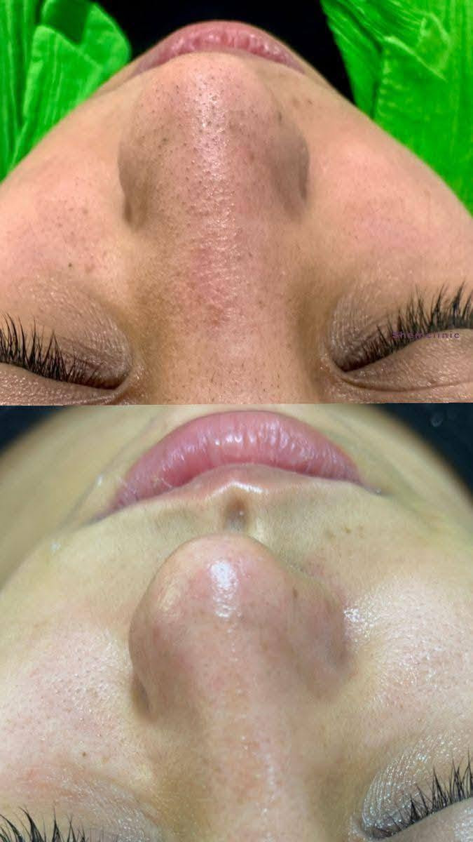 عروض عروض
تنضيف بشره عميق 10 
يشمل بخار+سناره+قناع طين+قناع اسود +سنفره للوجه+جهاز رؤوس السوده +صبغ حاجب 

تنضيف بشره عادي5
يشمل بخار +قناع +سنفره


**إذا كنت صاحب هذا الإعلان وتريد حذفه لأي سبب، رجاءا أرسل رسالة إلى الدعم الفني**