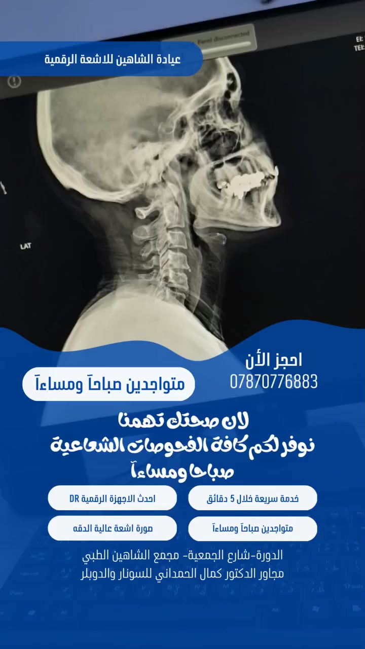 متواجدين من الساعة التاسعة صباحآ الى العاشرة مساءآ..
نوفر لكم جميع الفحوصات الشعاعية وباحدث اجهزة التصوير الشعاعي. 
عيادة الشاهين للأشعة الرقمية / الدورة شارع الجمعية  
متواجدين قبل وبعد الفطور 
للحجز 
***********
الدورة-شارع الجمعية مجمع الشاهين الطبي مجاور الدكتور كمال الحمداني للسونار
