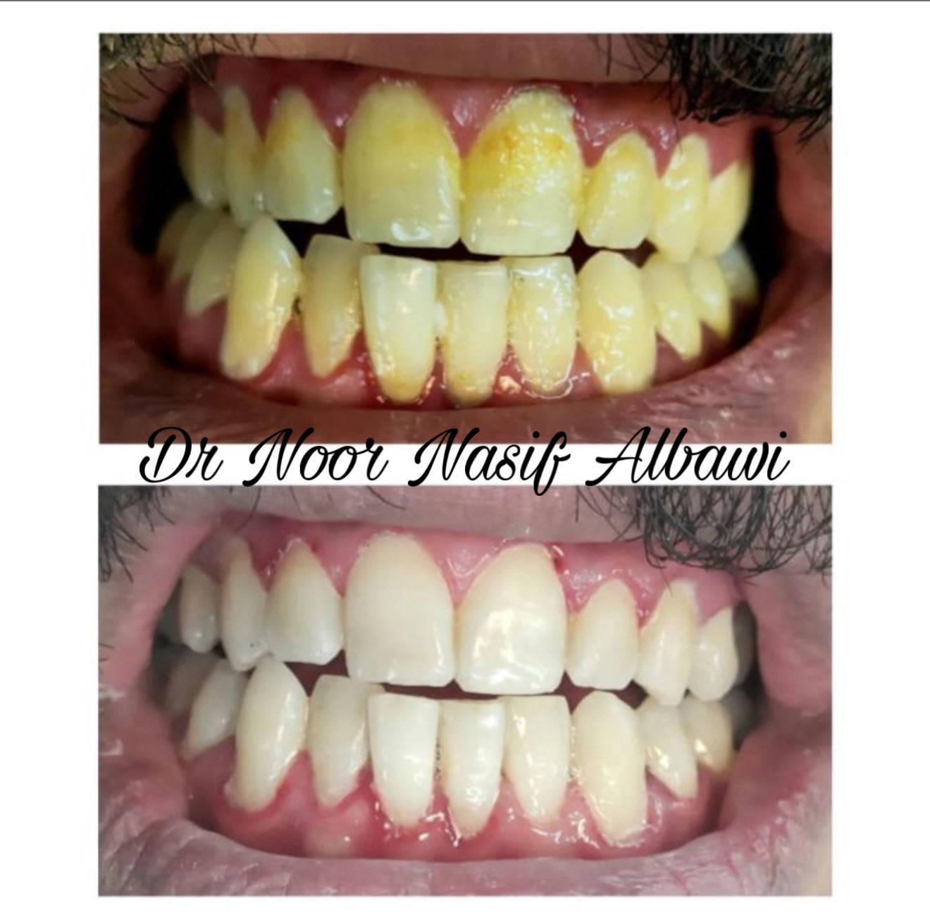 يعلن مركز الماس عن تواجد الدكتورة نور الباوي
في شهر رمضان ايام ( سبت / احد / اثنين / ثلاثاء) 
من الساعة ٧ الى ساعة ١٠ مساءا

📍بغداد / الحسينية / شارع الجريخي بناية مطعم جكن اوسلو سابقاً ( الطابق الارضي) 

للحجز والاستفسار 👈 ***********
