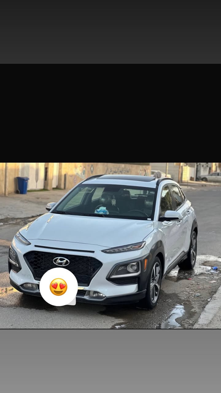 السلام عليكم كونا 2018 فول مواصفات1/1 N Lain فتحه بصمه رادارات جانبيه حساسات خلفيه ويل كب رياضي اشاير بلمري محرك 1600 تيربو توقف ذاتي شاشه كامرا دواره كشنات جلد تبريد ثلج  گير محرك خير من الله تحكم ستيرن جهتين فور ويل تدفئه كشنات  كشن سايق كهرباء حادثهه جاملغ وبنيد نفسهن مسوينهن  رقم بغداد دولي بأسمي  هزه جديده سنويه 2030 سعره 128 بيهه مجال للطيبين مكاني بغداد عبيدي رقمي ***********
