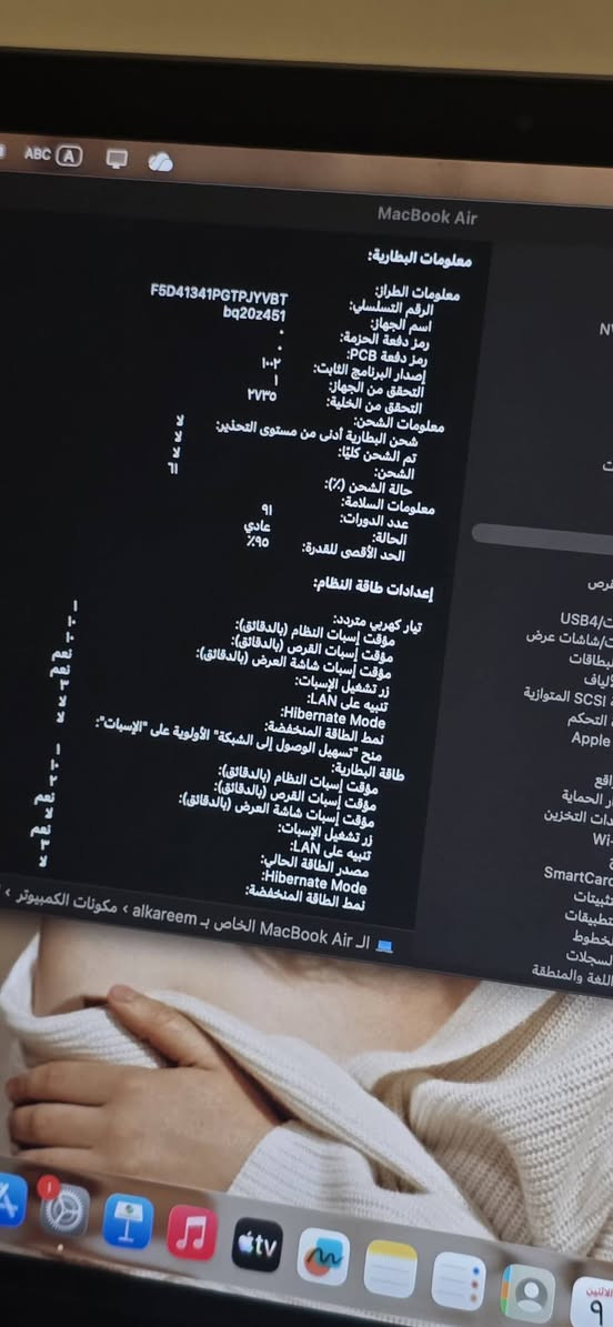 📱 للبيع: MacBook Air M1
🔹 الموديل: Apple MacBook Air 13.3" بشريحة M1
🔹 الذاكرة: 8 GB RAM
🔹 التخزين: 256 GB SSD
🔹 عدد دورات الشحن: 91
🔹 صحة البطارية: ~95%
🔹 اللون: (grey)
🔹  الحالة: مستخدم بحالة ممتازة
🔹 الوكالة: iCenter (ضمان/خدمة)
🔹الملحقات: الشاحن الأصلي
🔹 السعر المطلوب: (800,000)


**إذا كنت صاحب هذا الإعلان وتريد حذفه لأي سبب، رجاءا أرسل رسالة إلى الدعم الفني**