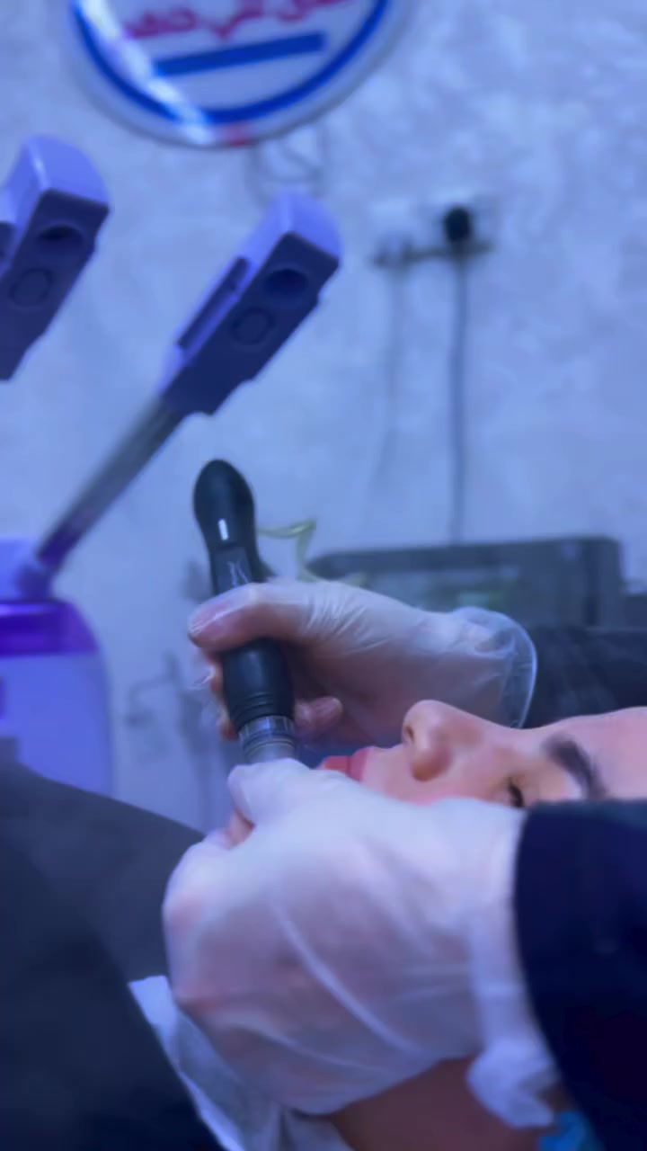 تنظيف البشرة العميق في مركز الهدى الطبي ✨استعيدي نضارة وجهك وجمال بشرتك مع جلسات العناية المتقدمة بإشراف مباشر من الدكتورة هدى علي كاظم 💆‍♀️🌿📌 فوائد الجلسة:✅ إزالة الشوائب والرؤوس السوداء✅ تقشير خلايا الجلد الميت✅ ترطيب وتغذية البشرة✅ تفتيح وتوحيد لون البشرة✅ بشرة ناعمة ونضرة من أول جلسة!📍 المكان: مركز الهدى الطبي – ميسان📞 للحجز والاستفسار: المراسلة خاص 📅 احجزي موعدك الآن وتألقـي ببشـرة صحية


**إذا كنت صاحب هذا الإعلان وتريد حذفه لأي سبب، رجاءا أرسل رسالة إلى الدعم الفني**