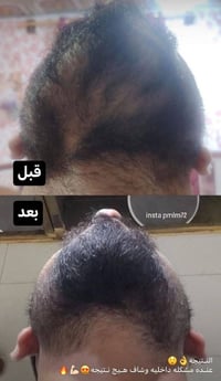 نتيجة زبونتنا • عناية بالشعر • مستحضرات تجميل