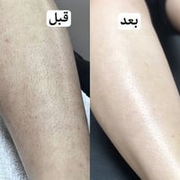 للاستفسار والحجز واتساب 07747724031 تردين جسم ناعم وشعر يقل وية الاستم...