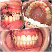زراعة اسنان • تقويم اسنان • قيارة