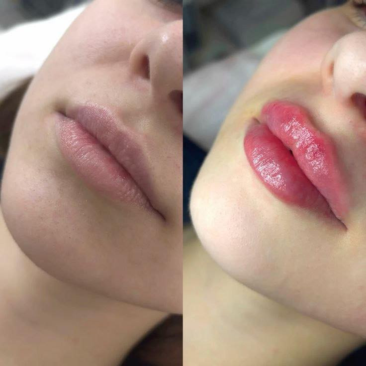 ✨ توريد الشفاه في مركز عشتار بيوتي ✨

احصلي على شفاه وردية طبيعية وجذابة مع أحدث تقنيات توريد الشفاه في مركز عشتار بيوتي 💋

🎉 بمناسبة العيد خصومات تصل إلى 50% لفترة محدودة!

📍 العنوان: الحرية الثالثة – أبو جفات – فوق مطعم كرسبي
📞 للحجز والاستفسار: ***********

دللي نفسك بإطلالة أجمل وثقة أكبر قبل العيد �
