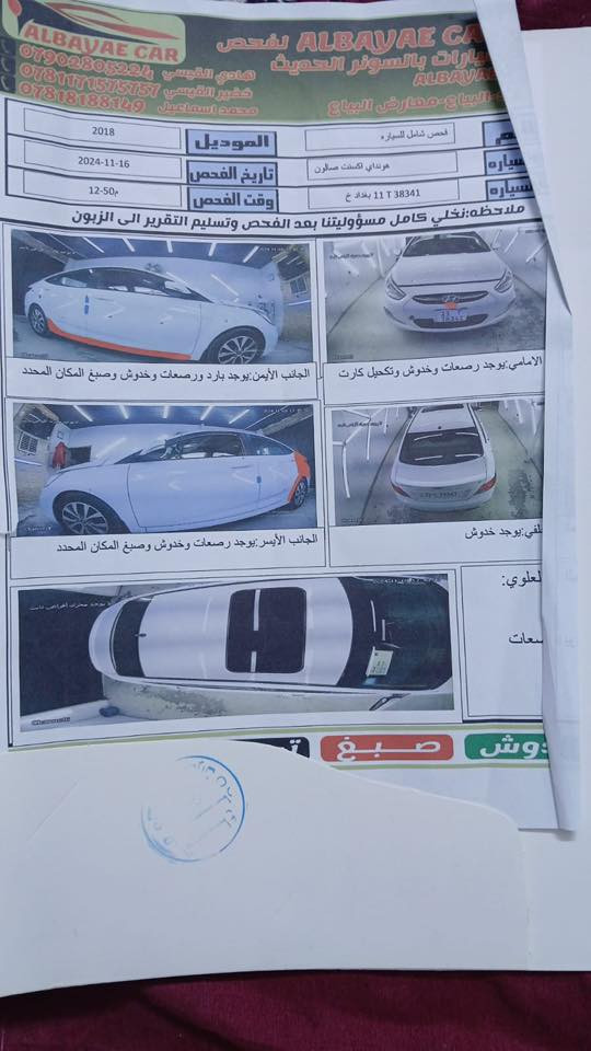 السلام عليكم
اكسنت موديل ١٨ خليجي ١٦٠٠ دوش فول 

السعر ١١٧٠٠

بغداد باسمي تحويل 

بيه سونار مرفق مع الصور 

السياره بيه شويه بالدوسه والجاملغ الخلفي فقط والباقي كله مكفول 

ماشيه ١٠٦ الف كيلو 

الاتصال *********** نبيل
