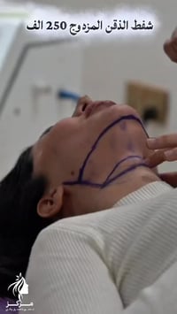 " ودّعي الذقن المزدوج واستعيدي تحديد وجهك الطبيعي إذا كنتِ تعانين من ا...