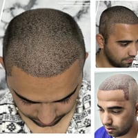 بعد مرور ١٠ ايام❤️💎  الكثافه الي تحلم بيها !!!🔥 🔥صارت ممكنه ويا مركز أ...