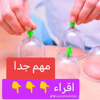 حجامة يوم ٧ - ١٤ - ٢١ حزيران عن أبي الحسن عليه السلام قال : لا تدع الح...