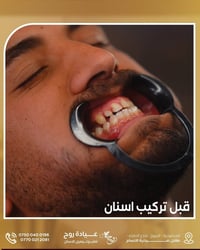 عيادة روح • تجميل أسنان • المحمودية