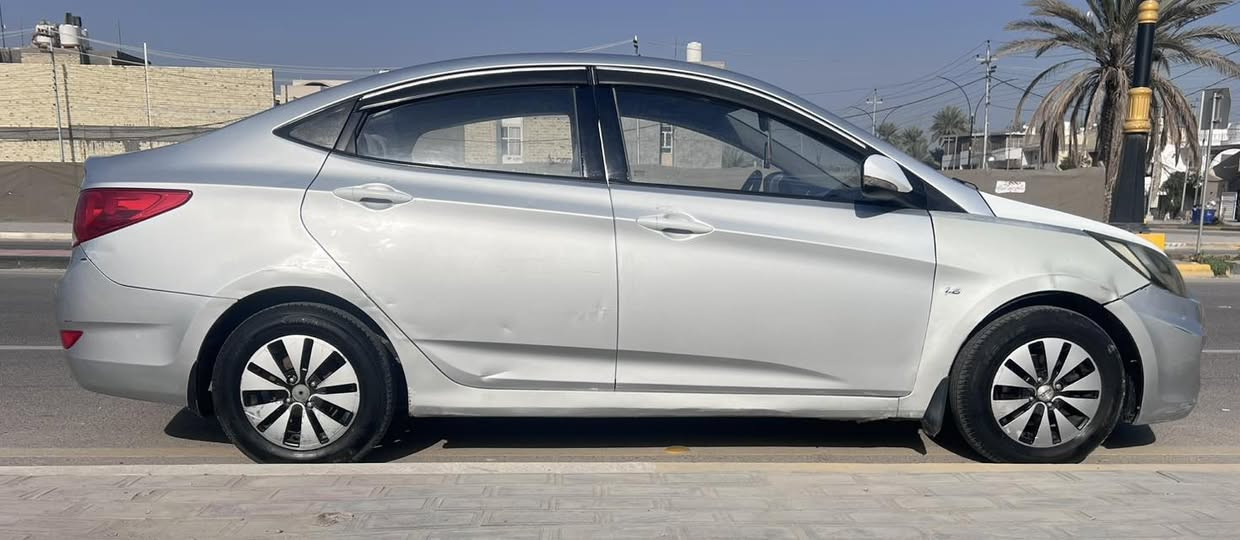 اكسنت ٢٠١٣ خليجي للبيع
-محرك ١٦٠٠ 
-كامرة خلفية وشاشة
-رقم كربلاء اصولية بالكامل باسمي
-سنوية ٢٠٣٠ ورقم الجديد
-ماشية ٣٣٣ ولكن المحرك مبدل

العنوان كربلاء / السعر ٨٨ وبيه مجال
التواصل على الخاص


**إذا كنت صاحب هذا الإعلان وتريد حذفه لأي سبب، رجاءا أرسل رسالة إلى الدعم الفني**