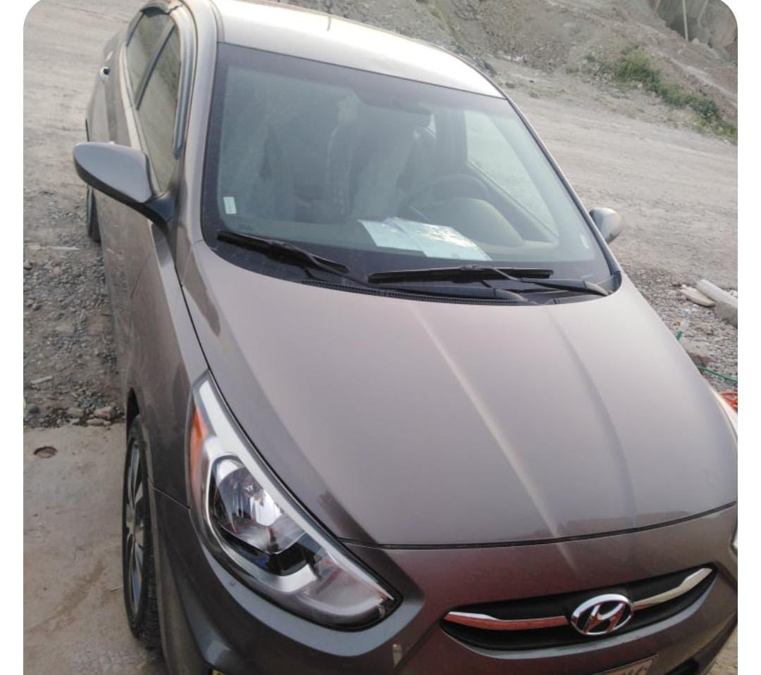 للبيع سيارة اكسنت وارد أمريكي موديل ٢٠١٧
گير توماتيك جامات كهرب شاشة كاميرا خلفيه نظام اقتصادي تدفئة و تبريد فول طخم تايرات جديد گير شرط و محرك ما مفتوح 
للاستفسار الاتصال على الرقم 
***********
