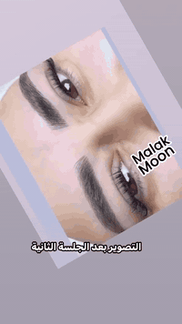 وصل ضمان باللون والعمل ميكمل الشغل الا بعد الجلسة الثانية  عروض راس ال...