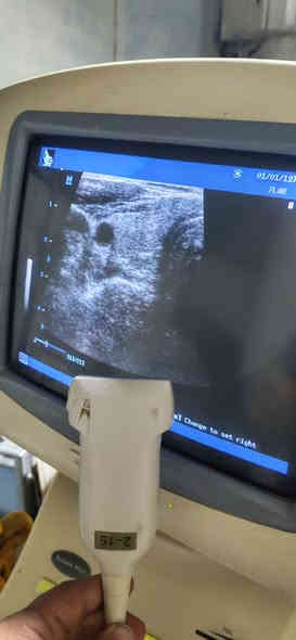تحية طيبة
يتوفر سونار نوع mindray Dc6 بروب واحد liner
صورتة جدا ممتازة
انتاج 2014
وبسعر جدا جدا مناسب 💥💥💥
للاستفسار واتس اب ***********
او ارسال رسالة على الخاص
#سونار #ايكو #لينير #thiroid #crt #msk #caroted #sup #abdomin #bawoul
