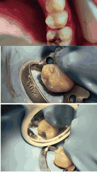 عودة عيادات جامعة الاسراء للعلاج المجاني
لكل من يعاني من اسنانة مع توفر عيادات اطفال التواصل و الحجز على الرقم***********
اروجوا تبليغ من يعاني من امراض 
السكر او الضغط ..الخ 
لأتخاذ الاجراء اللازم
