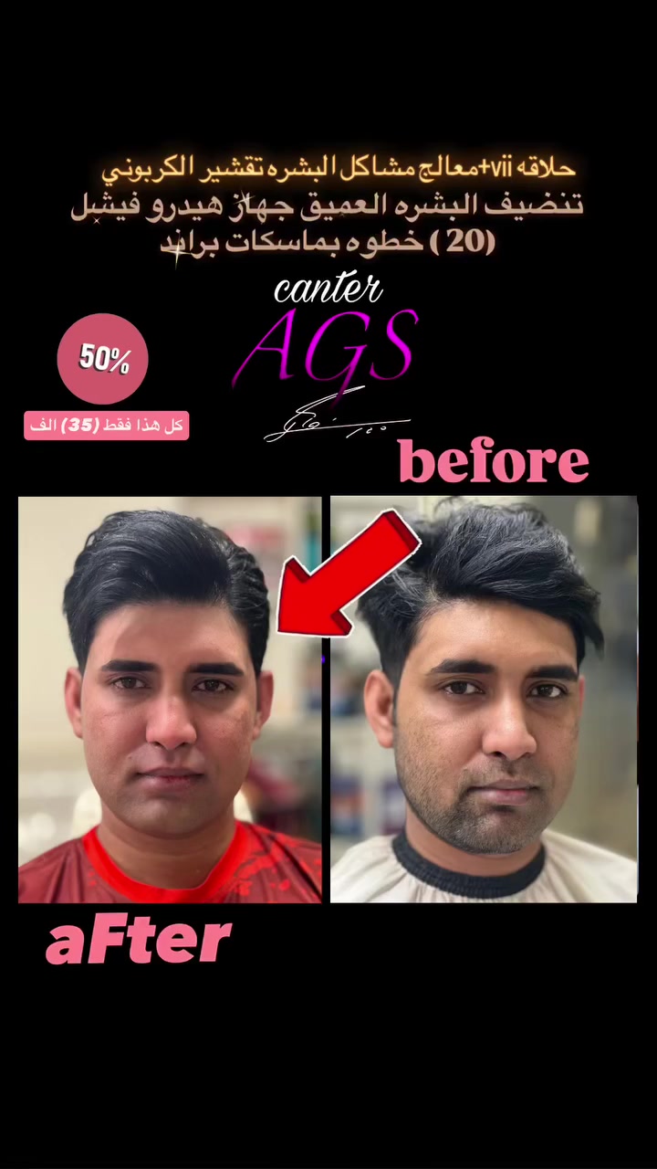 #مركز_AGS_للعنايه_بالرجل
#لايك__explore___
#تنضيف_البشره_العميق
#اصباغ_الشعر
#للحجز_***********
#اكسبلور
#حلاقين
#مشاهيرالعراق
#مشاهيرفيسبوك
