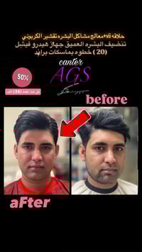 #مركز_AGS_للعنايه_بالرجل #لايك__explore___ #تنضيف_البشره_العميق #اصباغ...