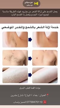 ازالة شعر • مساج كامل • البياع بغداد