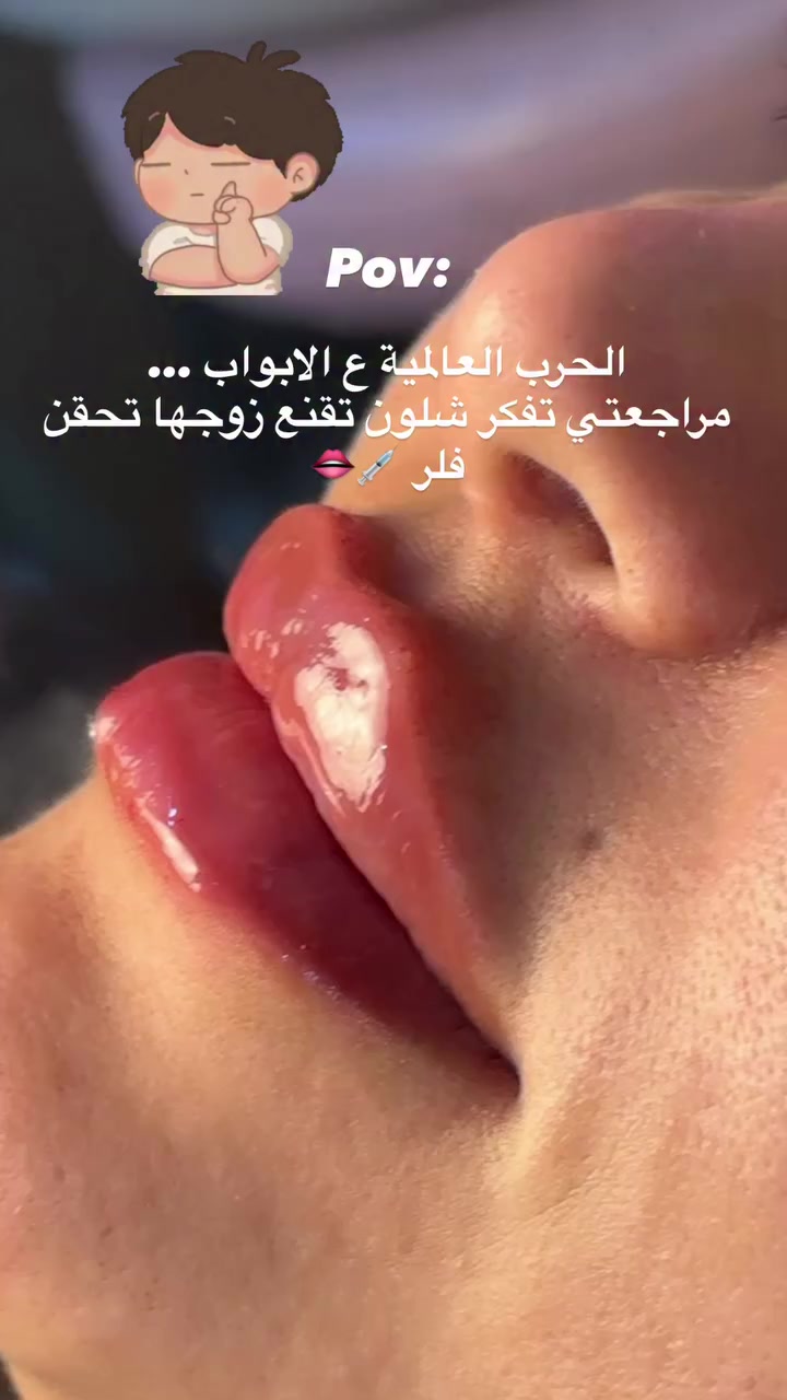 #فيلر ورسماته يمي وبس 😎


**إذا كنت صاحب هذا الإعلان وتريد حذفه لأي سبب، رجاءا أرسل رسالة إلى الدعم الفني**