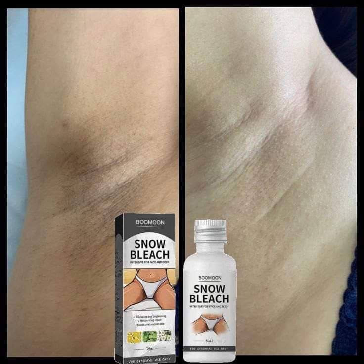 كريم عملاق التفتيح الفائق💎 ✨SNOW BLEACH ✨
احصلي على بياض الثلج خلال ثلاث ايام❄️❄️
• منتج طبيعي وامن للمناطق الحساسه وتحت الابطين 
وصل اليوم عملاق التبييض وتفتيح الوجه والمناطق الحساسة من شركة SNOW BLEACH
كريم التبييض  المصنوع من مكونات نباتية طبيعية 100%، يحتوي على نياسيناميد وفيتامين C   ومستخلص آسياتيكا والبابونج وغسول تجديد البشرة 

✅ يستخدم للمناطق الحساسة وتحت الابط والكوع والركبة وبين الافخاذ 

✅ تفتيح بنسبة لا تقل عن 30% بعد 9 أيام*.

✅ خالٍ من الهيدروكينون أو الستيرويد أو كويكسيلبر أو أي مكونات ضارة أخرى

✅ أفضل نتيجة مع الاستخدام الموصى به لمدة 30 يومًا.

✅ مكونات نشطة نباتية 100% وطبيعية تمامًا ومناسبة لجميع أنواع البشرة.  

✅ كريم طبيعي وفعال ل تفتيح البشره ومعالجه الاسمرار🍃 يحتوي على فيتامينات B, C, E والعديد من المعادن والاحماض الامينيه التي تساعد على تجديد خلايا البشره وتفتيحها ومقاومه العوامل المسببه لاسمرار المناطق

✅ يعمل على تفتيح وترطيب وتبييض البشرة ويجعلها مرنه واكثر ننعومة
منتج اصلي💯 انتبهوا نزل منه تقليد الغطاء مختلف ❌
السعر خاص
🚘 يوجد خدمة توصيل لجميع محافظات العراق  🚘


**إذا كنت صاحب هذا الإعلان وتريد حذفه لأي سبب، رجاءا أرسل رسالة إلى الدعم الفني**
