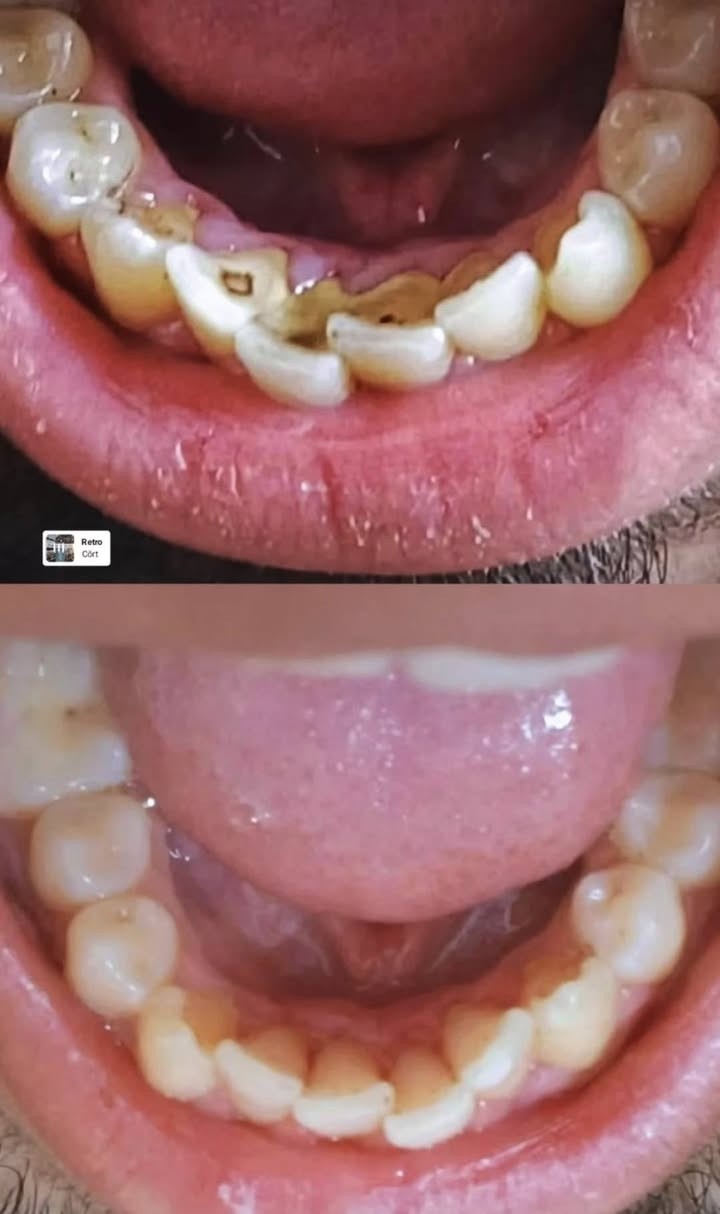 السلام عليكم
عيادة رينيو لطب وتجميل الاسنان
 بإشراف دكتورة كربلاء الاسدي بكلوريوس طب جامعه بغداد سرتفكيت فى التجميل اللاجراحي
للحجز: ***********
العنوان: بغداد مدينه الصدر قطاع 14 مقابل صورة السيـد .
