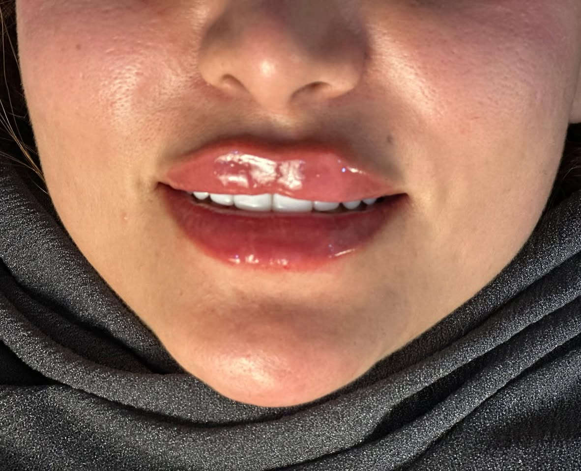 #فيلر


**إذا كنت صاحب هذا الإعلان وتريد حذفه لأي سبب، رجاءا أرسل رسالة إلى الدعم الفني**