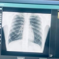 عيادة الرازي للاشعة  فحص جميع انواع الفحوصات الشعاعية العادية والملونة...