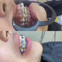 تقويم اسنان • د فاطمة جميل • الحسينية شارع المكاتب