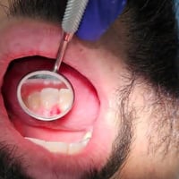 اي احد عنده اطفال جوة 14 سنة و يحتاجون حشوات اسنان او جلسات فلورايد  ا...