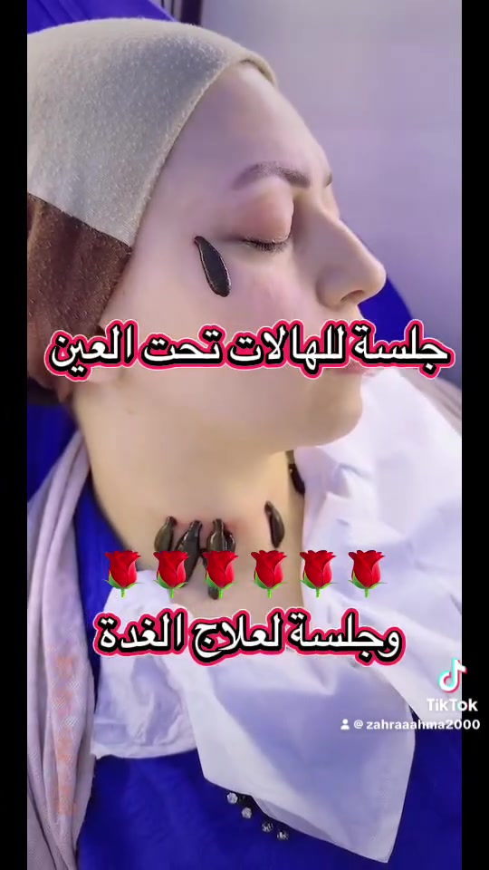 صحتك من قلب الطبيعة الدكتورة زهراء احمد ✨

نقدم في مركزنا خدمات العلاج بالطب البديل بأحدث الأساليب الطبيعية والآمنة، بإشراف مختصين وبأجواء صحية مريحة، للمساعدة في تحسين الصحة العامة والتخفيف من العديد من الحالات الشائعة وهي :

🔹 علاج آلام الظهر والرقبة والمفاصل
🔹 علاج الشد العضلي والانزلاق البسيط
🔹 الصداع والشقيقة المزمنة
🔹 مشاكل القولون العصبي واضطرابات الهضم
🔹 التوتر والقلق والأرق
🔹 تنشيط الدورة الدموية وضعف الأعصاب
🔹 المساعدة في حالات السكري والضغط بشكل تكميلي
🔹 السمنة وزيادة الوزن وبرامج التنحيف الطبيعي
🔹 مشاكل البشرة وتساقط الشعر
🔹 الإرهاق المزمن والخمول
🔹 جلسات الحجامة والعلاج الطبيعي والعلق الطبي ولسع النحل والطب الصيني 

🌿 نعتمد على وسائل علاج طبيعية وتكاملية تهدف إلى تحسين جودة الحياة وتعزيز راحة المريض.
📍 هدفنا سلامتكم وثقتكم هي أساس نجاحنا.
📞 للحجز والاستفسار مراسلتنا عبر الصفحة أو الاتصال بالمركز***********
