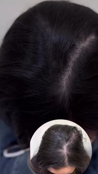 تجميل • كربلا • نتائج