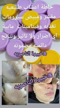 خلطة عشبية طبيعية • توصيل مجاني • جميع المحافظات