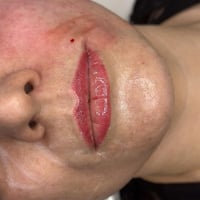 ✨تكبير وتحديد الشفاه بشكل ناعم وطبيعي تصحيح عدم التناسق بين الشفة العل...