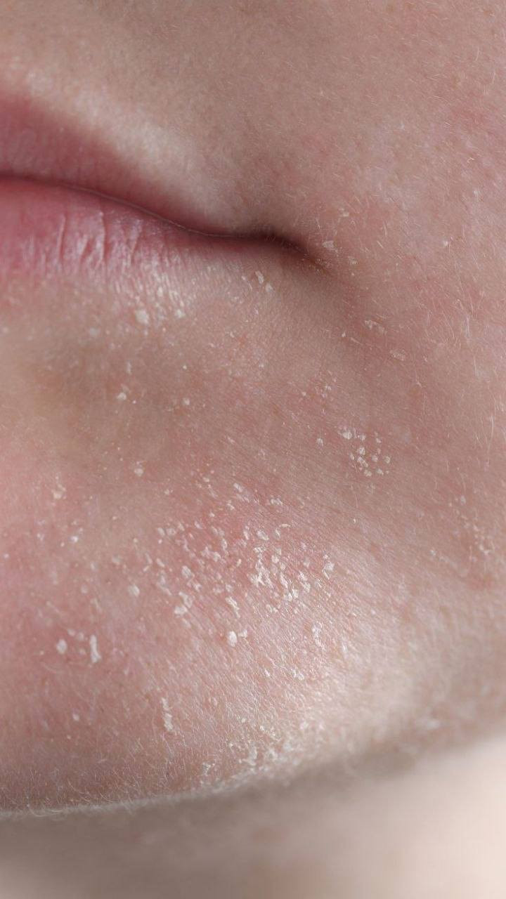 غسول Acm للبشرة الجافة 🔵
غسول جل للبشرة الجافة من ماركة اي سي ام 🦢🪼✧ 𓍢ִ໋💙
 تركيبة تزيل الشوائب بلطف دون تجفيف الجلد. خالي من العطور 

يرطب وينعم البشرة مناسب للاستخدام اليومي افضل غسول للبشرة الجافة الحساسة 
يعمل على تنظيف البشرة وترطيبها دون تهيجها الحجم 200ml

سعـر الـقُطعة / 15
سعـر القُطعتين / 23
الـتـوصيل لـبغداد 4 وللمحافظات 6
﹏﹏﹏﹏﹏﹏˚ 𓇼𓈒𓏸🎅🏻⋆⭒˚♥𓇼𓈒
أذا زبون طلب منتج ثاني وياة سعرة عابر 10 يصير خصم :
سعـر الـقُطعة / 8


**إذا كنت صاحب هذا الإعلان وتريد حذفه لأي سبب، رجاءا أرسل رسالة إلى الدعم الفني**