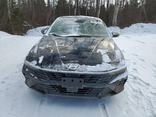 النترا موديل ٢٥ هايبرد ماشيه ٢٠حادث جدا بسيط
قبق جنطه فقط صبغ ما مبدل حوض سليم مكاني غزاليه 
سياره بسمي فوول مواصفات السعر 170بيهه مجال بسيط 
*********** بغداد, العراق
